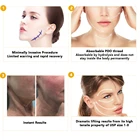 Medical Eye Medical Surgery 30g 38mm Eyebrow Filling Pdo Eye Thread With W Needle