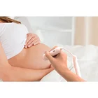 Heart Monitor Fetal Monitor Price Wellue Babytone Bluetooth Obstetric Ultrasound Doppler Fetal Heart Rate Monitor