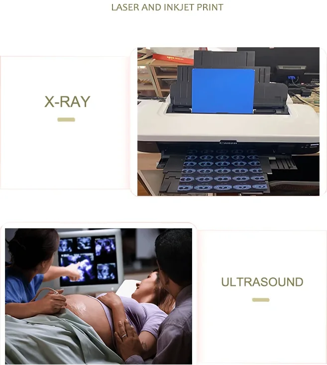 Pet White Inkjet Medical Dry Film Transparent Ultrasound Single Side Printing