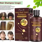 Hair Loss Shampoo Hair Loss Shampoo Manufacturers Hair Extension Hair Growth Organic Ginger Anti Hair Loss Shampoo