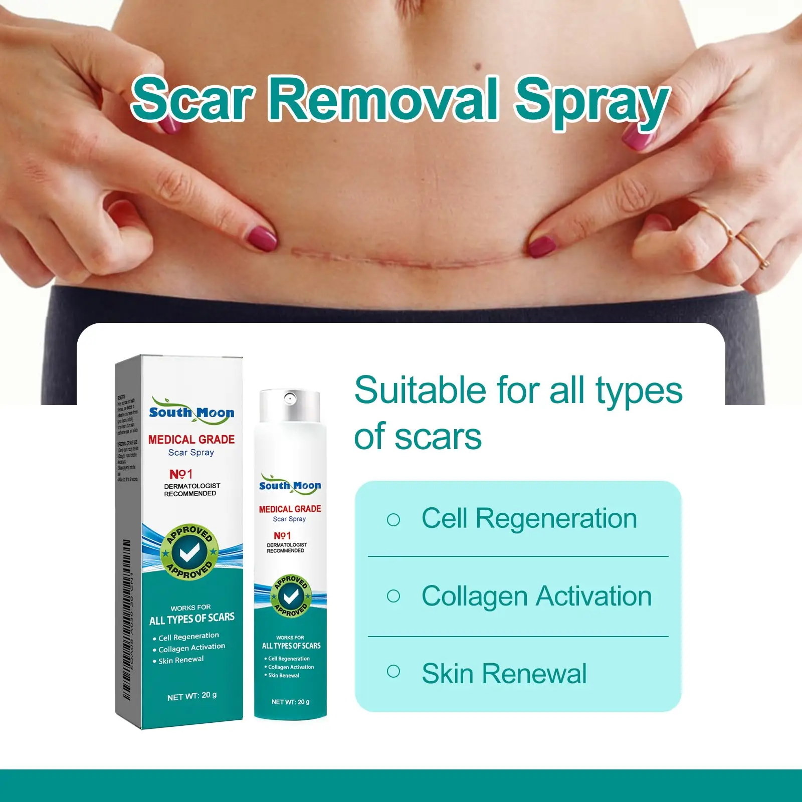 South Moon Scar Spray Cesarean Hyperplastic Contracture Burn Acne Surgical Scars Stretch Mark Keloid Treatment Liquid