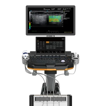T60 Trolley 3D/4D color doppler ultrasound machine