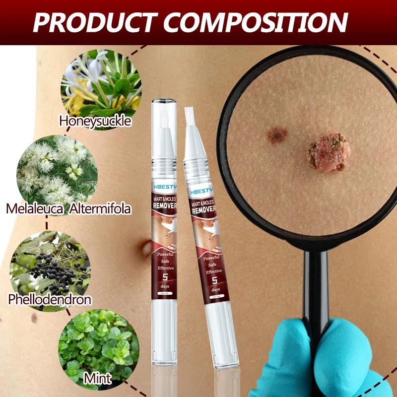 OEM Wart & Moles Cream for Improving Skin Problem