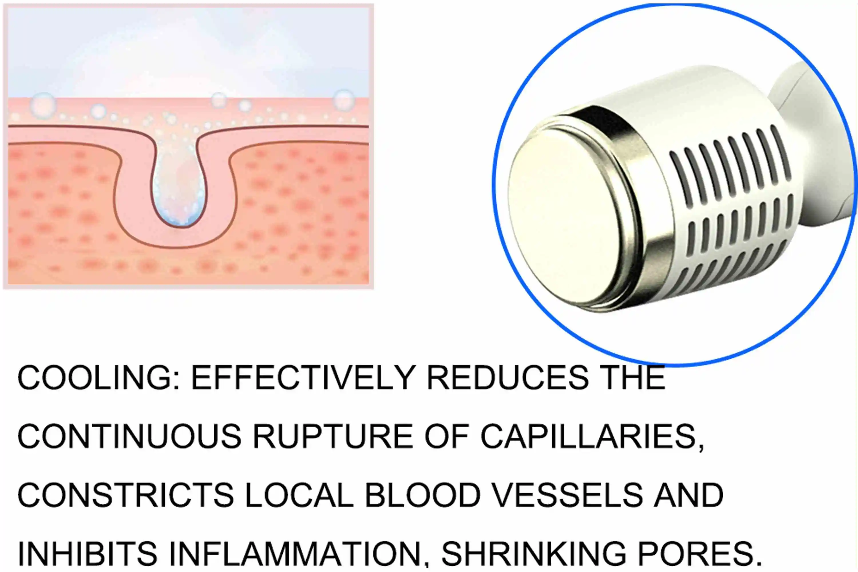 Skin Microdermabrasion Machine Hydrodermabrasion Exfoliation Microdermabrasion Blackhead Remover