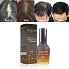 Natural Oil Hair Loss Products 100%organic Natural Material Private Label Anti Hair Loss Oil