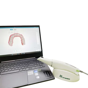 Dynamic DDS300 Professional Medical Devices Digital Dental 3D Scanner Intraoral Competitive Price