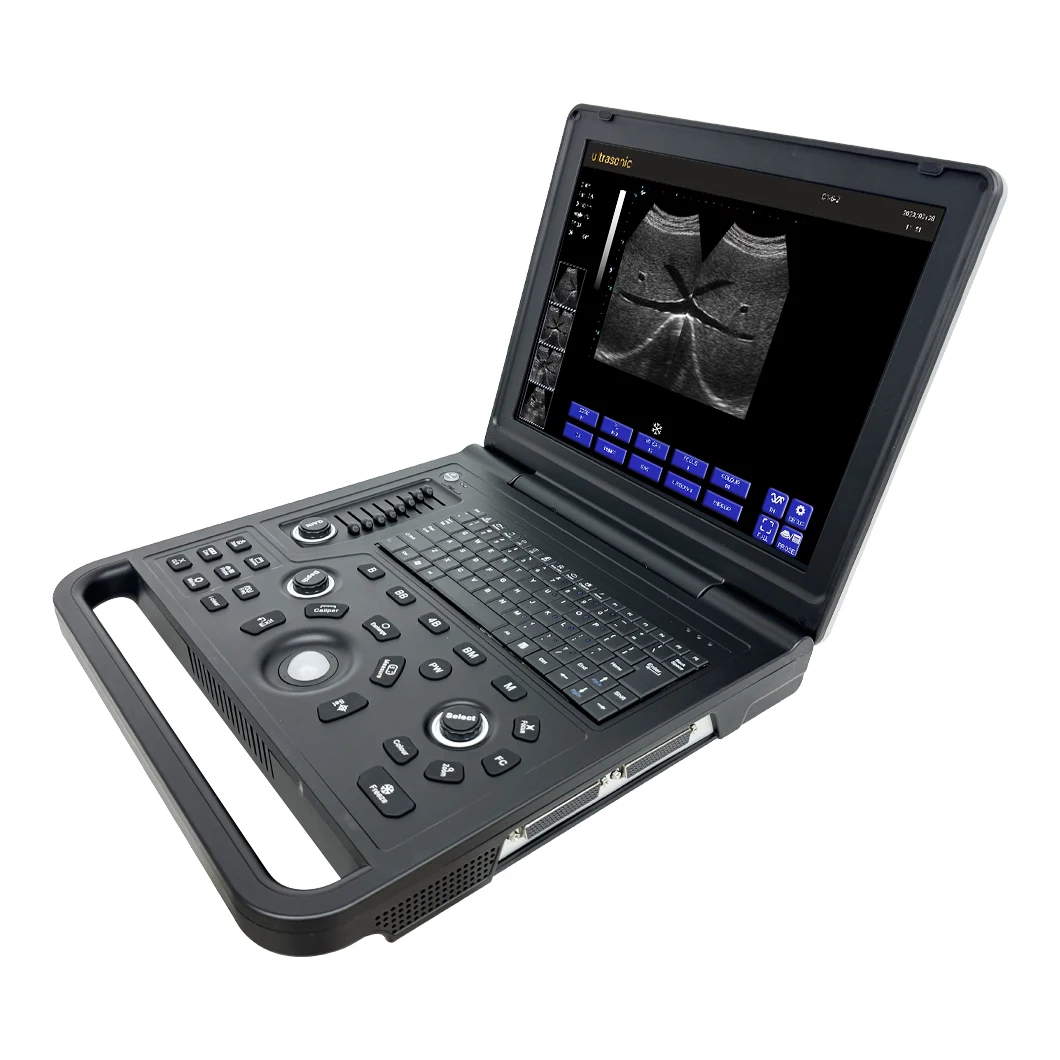 CE Approved Hospital Diagnostic Ultrasound Scanner Equipment Medical Portable Ultrasound Machine supplier