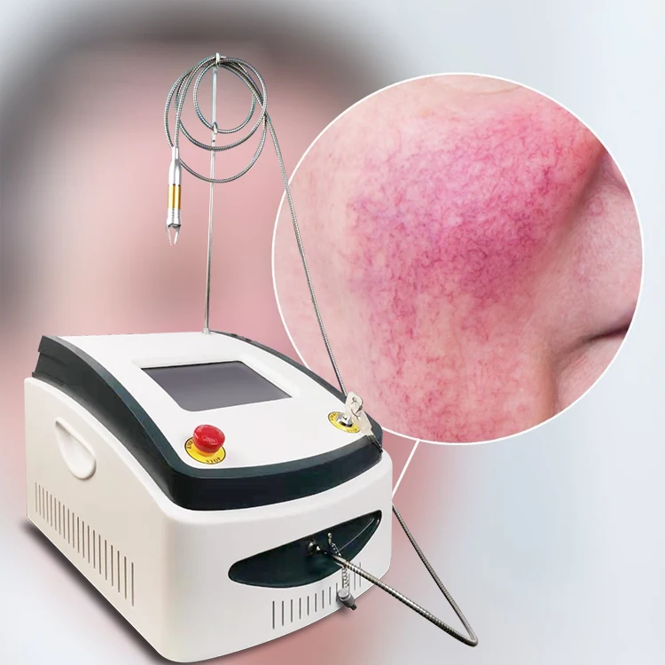 Vascular Laser 980 Nm Vascular Lesions Removal Diode Laser Ktp 15 Watt