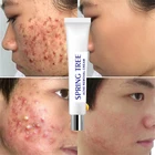Cream Night Creamnight Ready To Ship Acne Removal Cream Private Label Day And Night Face Cream For Acne