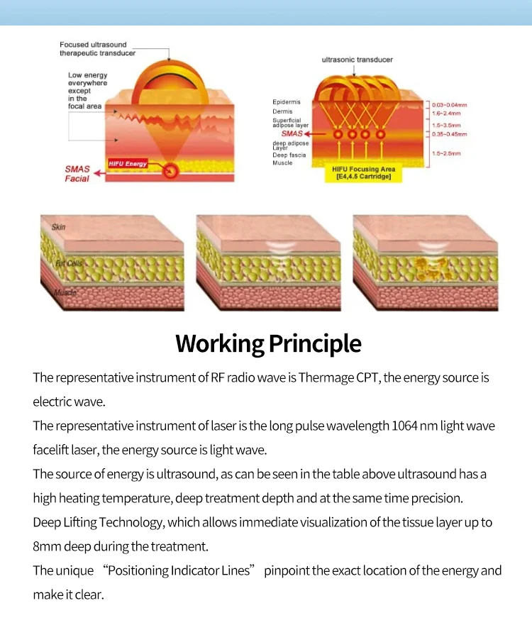 3rd Generation Ultra Lift HIFU Machine – Non-Surgical Face & Body Skin Tightening System 7 TECHNICAL SPECIFICATIONS <ul> <li>Power: 180W</li> <li>Voltage: 100V/110V/220V</li> <li>Screen Size: 18.5 inches touch screen</li> <li>HIfu Cartridges: ds10-1.5/ds10-1.5n/ds7-3.0n/ds7-3.0/ds4-4.5/ds7-4.5</li> <li>Cartridge Shots: 10,000 shots</li> <li>Dot distance: 1-2mm(Set unit 0.1mm)</li> <li>Frequency: 10MHz/7MHz/4MHZ</li> <li><span class="attr-name J-attr-name" title="HIFU Length" data-spm-anchor-id="a2700.wholesale.0.i34.67a066f4kJ6h3j">HIFU Length: </span>5.0~25mm 1mm/step</li> <li>Package Size: 55*54*37CM</li> <li>Package Weight: 21 kg</li> <li>ReturnPolicy: <b class="magic-5"><span style="color: #2196ed;">30 Days Money back guarantee</span></b> <a href="http://skintechx.com/refund_returns" data-sm="true">Return Policy</a></li> <li>ShippingDetails: <b class="magic-5"><span style="color: #2196ed;">FREE SHIPPING fast delivery</span></b> <a href="https://skintechx.com/shipping-policy" data-sm="true">Shipping policy</a></li> </ul> 3rd Generation Ultra Lift HIFU Machine – Non-Surgical Face & Body Skin Tightening System