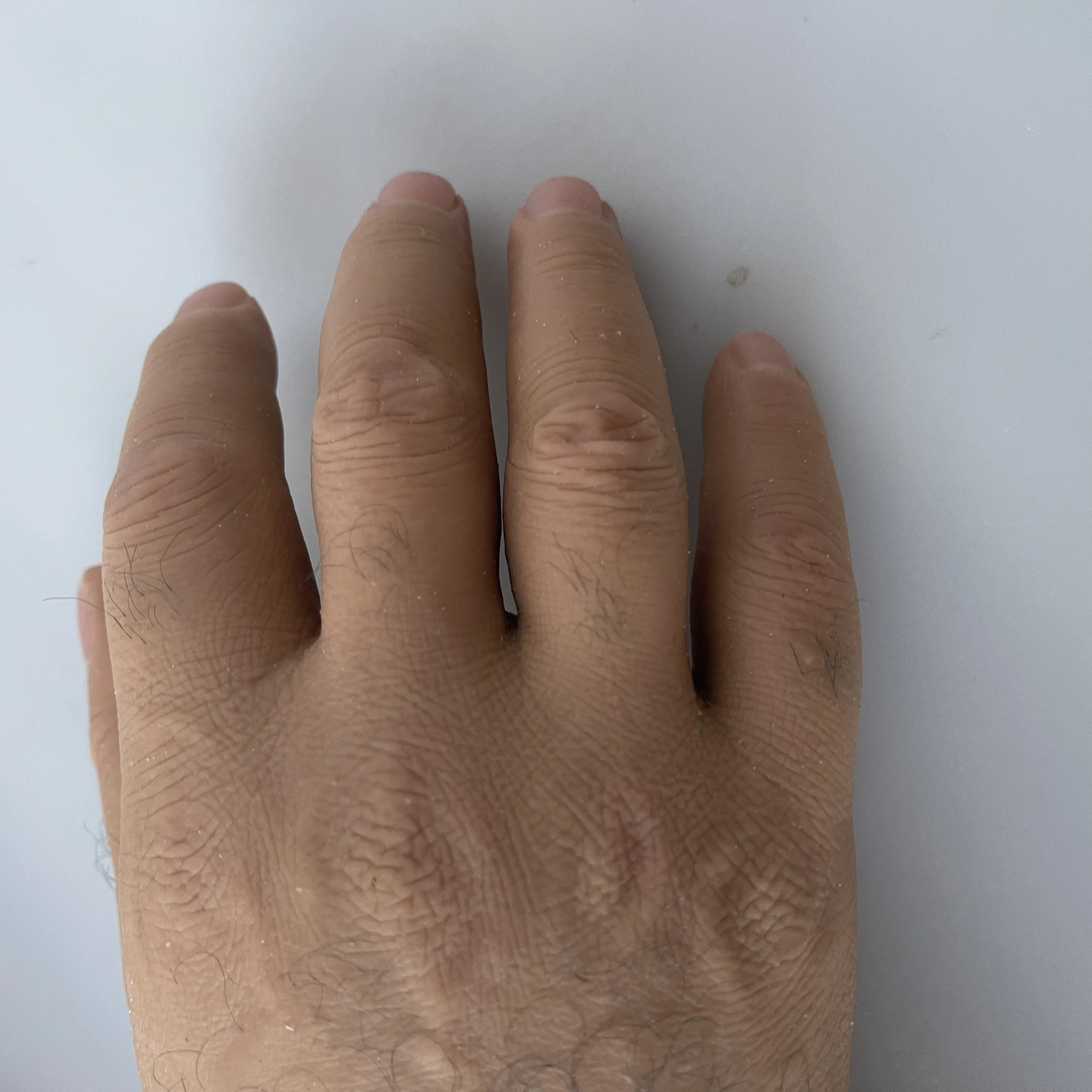 Customized Silicone Cosmetic Hand Implants Realistic Glove Prosthetic Artificial Limb Interlocking Nail Zipper Class I