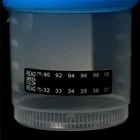 Easy To Operate Good Sealing Disposable Sterile Urine Sample Cups Container