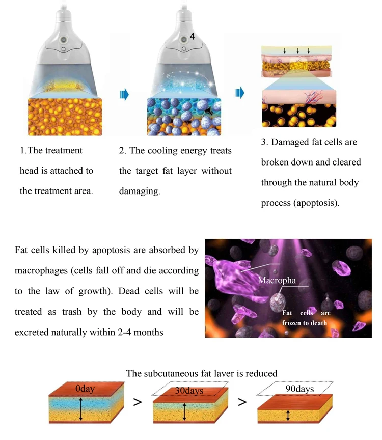 Cryolipolysis Fat Freezing + Ems Sculpting Machine 4 Fast Result Exercise Weight Loss Slimming Machine New Tech Rf Ems + Cryolipolysis Machine For Cellulite Removal Body Shape 2024
