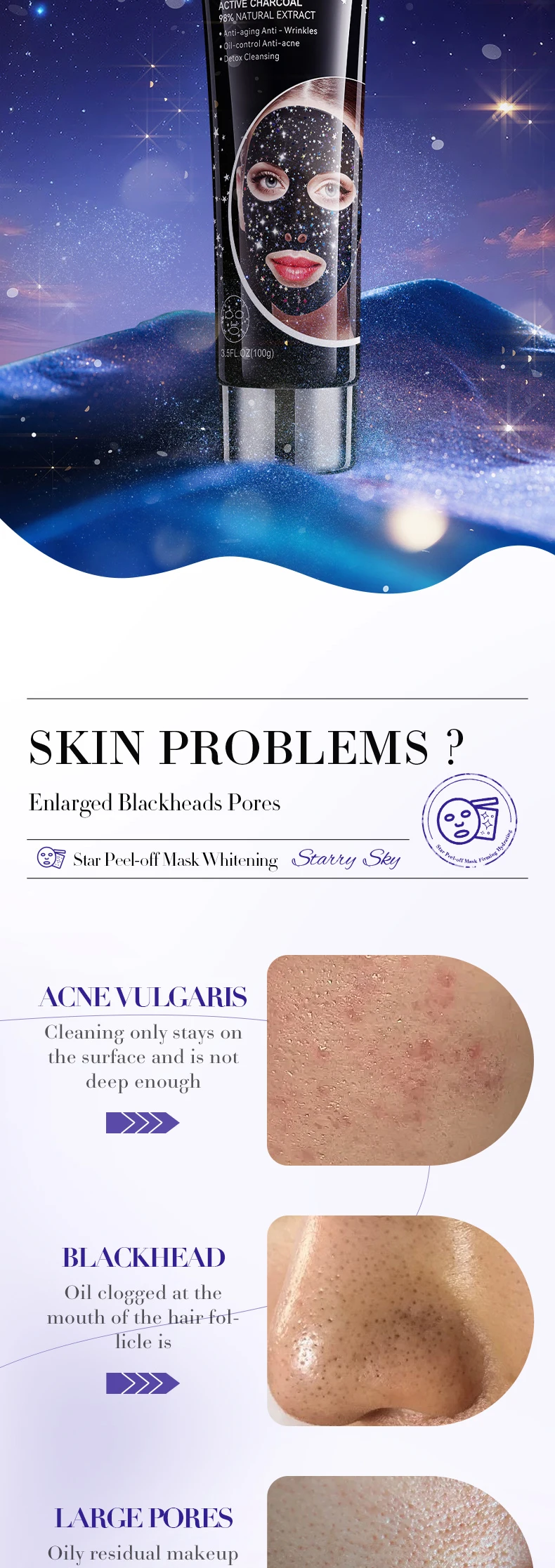 product 100g sadoer starry sky face and body mask for blackhead acne removal deep cleaning multi style adsorption peel off face mask-8
