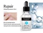 Light Freckles OEM Private Label Lightening Skin Care Products Whitening Light Freckles Skincare Set