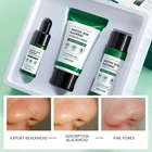 Skin Care Acne Hot Sale Face Skin Care Set Acne Treatment Anti-aging Brightening Beauty Face Acne Treatment Set