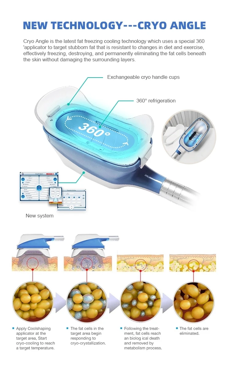 Kryolipolyse 2024 Model 360 Freezing Fat Cell Slimming Machine 5 Cryo Handles Body Cavitation Slimming Machine/Multifuctional Vacuum Cryo 4 Cool Handles Fat Removal Chin Criolipolisis Sculpting Machine Body Slimming 360 Cryo For Salon/Fat Freezing Machine Freezing Machine/4 Handle Cryo Fat Slimming Machine 