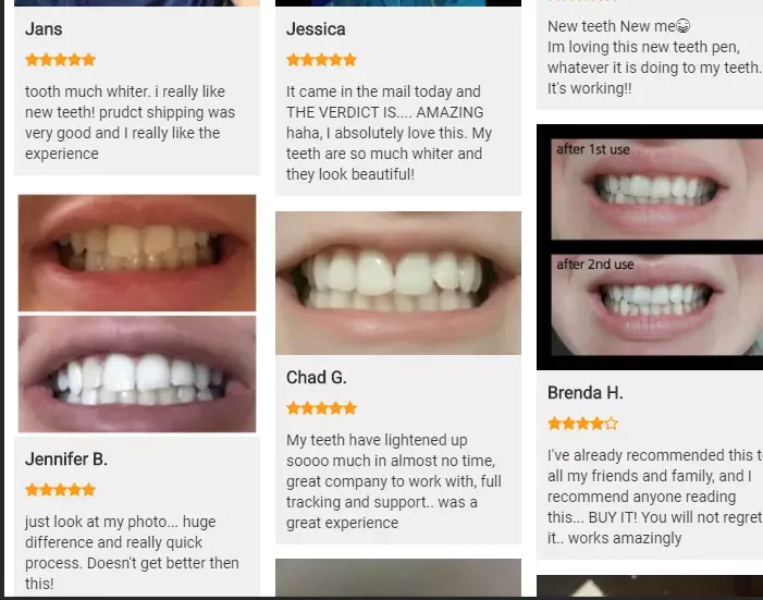 Bleaching 2 Persons Home Kit Dental Led Lamp Private Label Teeth