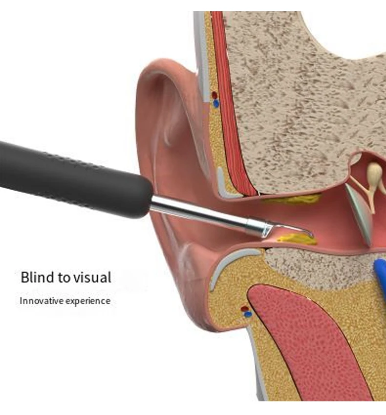 Hot Selling Electric Visual Ear Scoop With High Quality At Home Buy