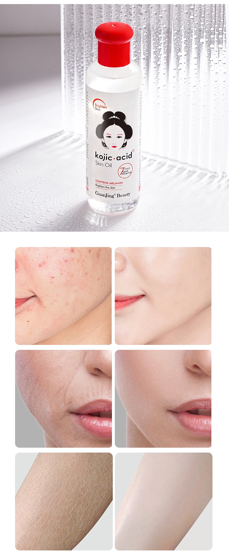 Guanjing Kojic Acid Skin Oil Face Brightening Smooth Skin Tightening Lightens Melanin Skin Rose Body Essential Oil