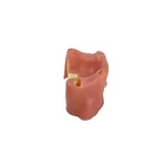 Model Titanium Standard Dental Implant Model