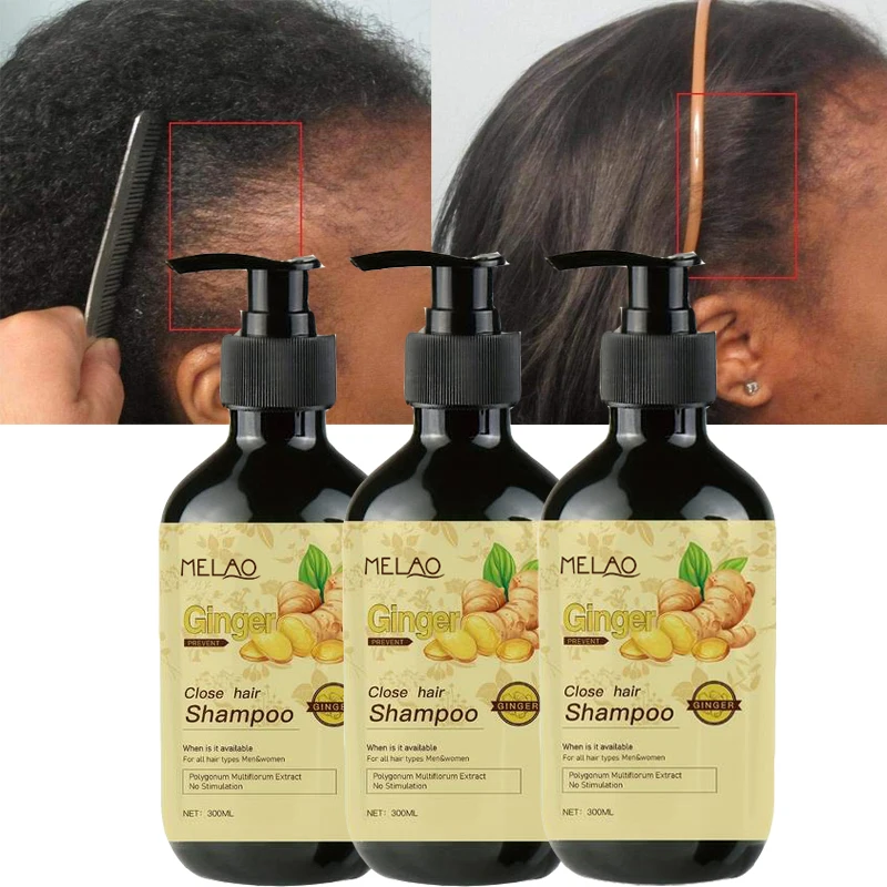 2-in-1 Ginger Hair Growth Shampoo 300ml Anti Hair Loss Nourishing Formula Repair Anti-Dandruff Prevention Shampoo For Men Women
