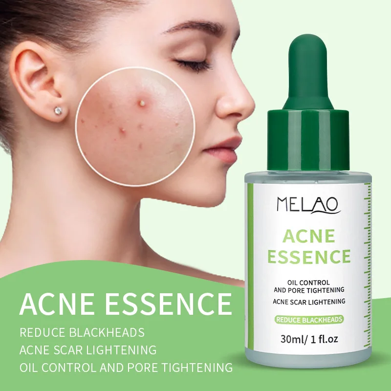 Salicylic Acid Pore Shrink Essence Oil Control Acne Repair Face Moisturizing For Blackheads Acne With Active Ingredients