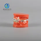 Model Factory Made Irregular Dental Orthodontic With Red Base Model