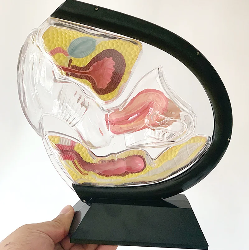 Medical Female Transparent Uterus Model Gynecological Demonstration