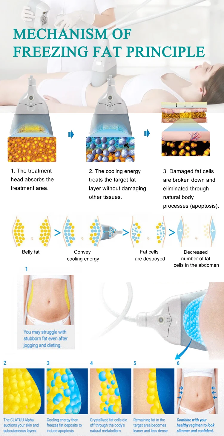 FAT FREEZING  (5)