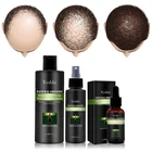 Regrowth Regrowth Anti Hair Loss Spray Treatment For Men And Women