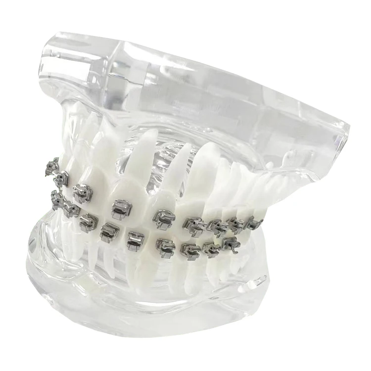 Orthodontic Band Orthodontic Brackets Mbt System Oral Braces Self