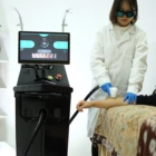 Hair Removal Laser Machine Factory Direct Sales Cheap Fiber Coupled Diode Laser Hair Removal Laser Machine