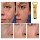 Skin Whitening Cream Acne Cream LANBENA TCM Herbal Scar Acne Scar Away Removal Oil Serum Face Skin Whitening Cream Lotion Creme Blanchissante Visage