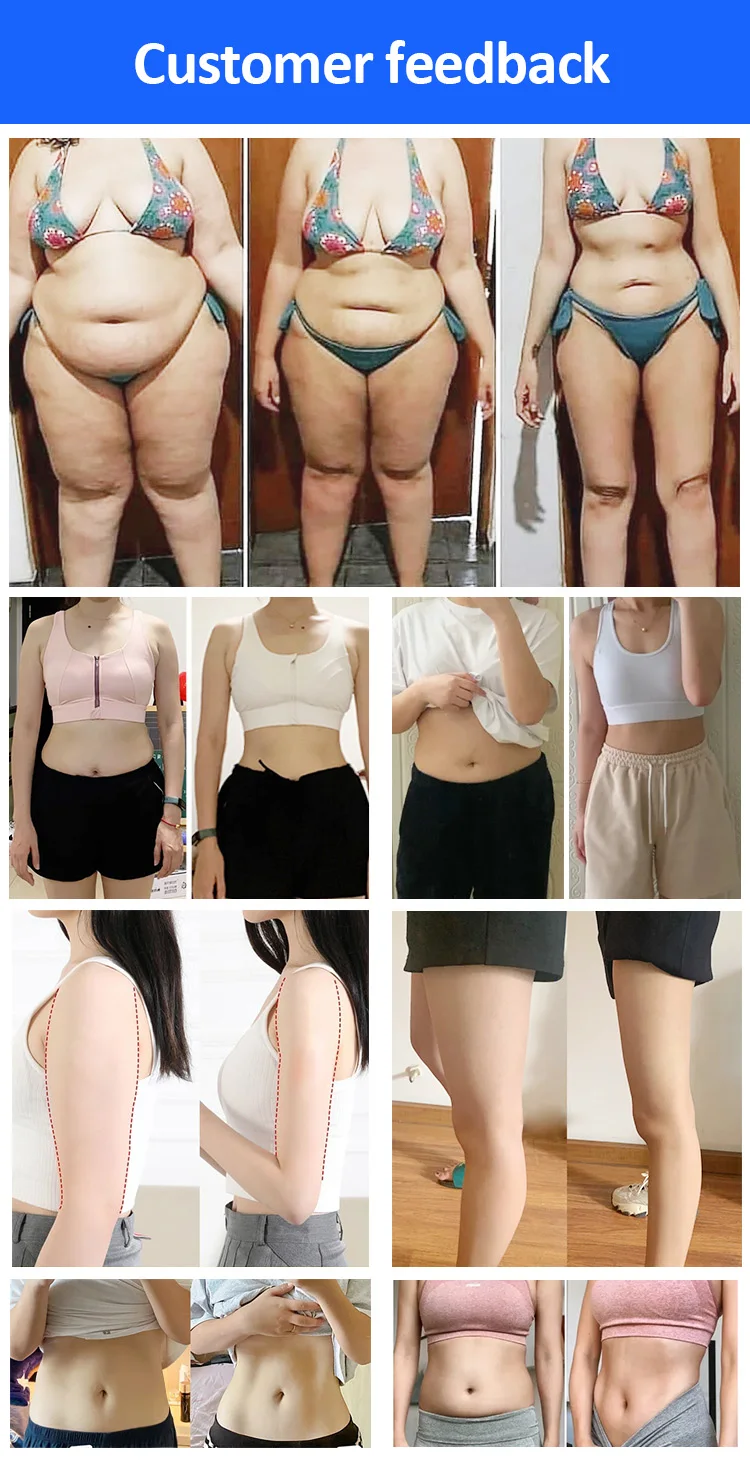 XM278 Maxlipo Body Shape System Four Cryo Plates Cryolipolysis Machine