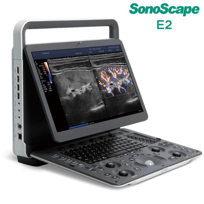 sonoscapee22