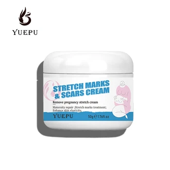 Available 100 % Natural Pregnancy Stretch Marks Removal Cream Anti Stretch Mark Cream For Body Care