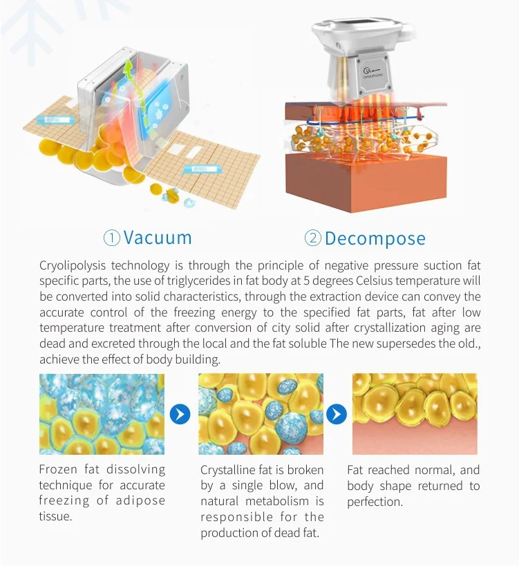 Cryolipolysis Fat Freezing Machine 4 Handles 5 <h2>Key Features of  Cryolipolysis Fat Freezing Machine</h2> <ul> <li>Achieve Your Dream Body Today</li> <li>Innovative Fat Freezing Technology</li> <li>Transform Your Shape with Ultrasonic Cavitation</li> <li>Firm and Sculpt with Lipo Laser</li> <li>Experience Exquisite Body Shaping Solutions</li> </ul> <div id="gtx-trans" style="position: absolute; left: 57px; top: 40.5156px;"> <div class="gtx-trans-icon"></div> </div> Cryolipolysis Fat Freezing Machine 4 Handles