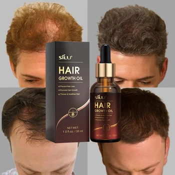 Private label 100ml hair grow edge control product lotion mens hair grow serum oil to make hair grow faster for women