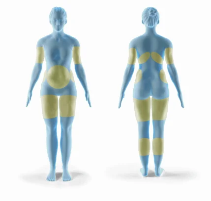 Ice sculpting body machine freezing ice sculpting machine