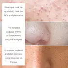 Removal Lanthome Best Natural Open Facial Pores Minimizer Anti Wrinkle Removal Vitamin A Cream