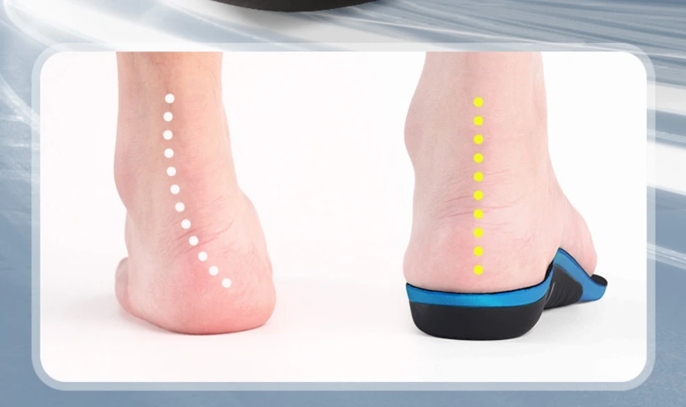 Medical Insole Arch Support Orthotic Corrective Foot Beds Valgus Correctors Orthopedic Shoe Inserts for Sports Training Medical Insole Arch Support Orthotic Corrective Foot Beds Valgus Correctors Orthopedic Shoe Inserts for Sports Training