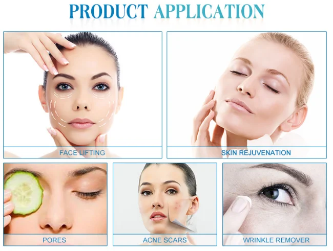 2023 No Needle Fractional Rf System Skin Rejuvenation Fractional Flx Cpt Machine Radio Frequency Microneedle Beauty Equipment