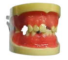 New Design Dental Training Model Implant Tooth Model