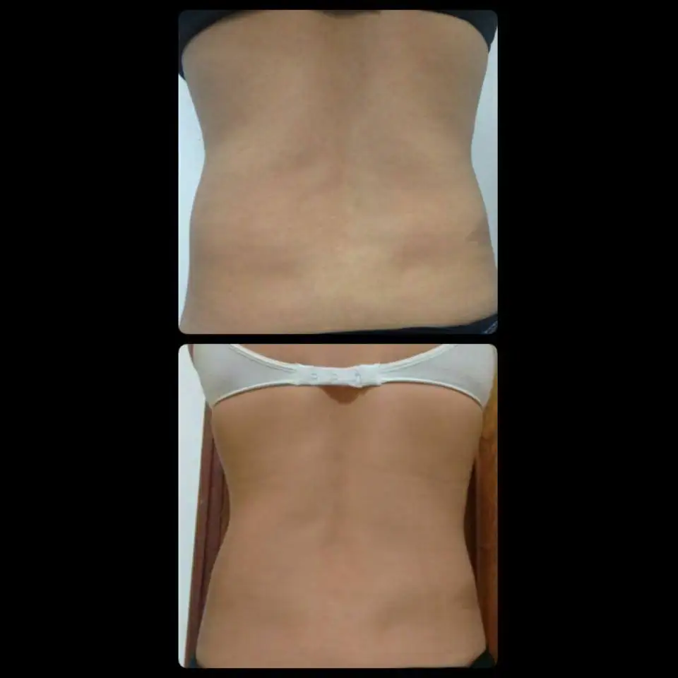 Sincoheren cooplas high quality performance cold sculpting beauty salon machine with CE