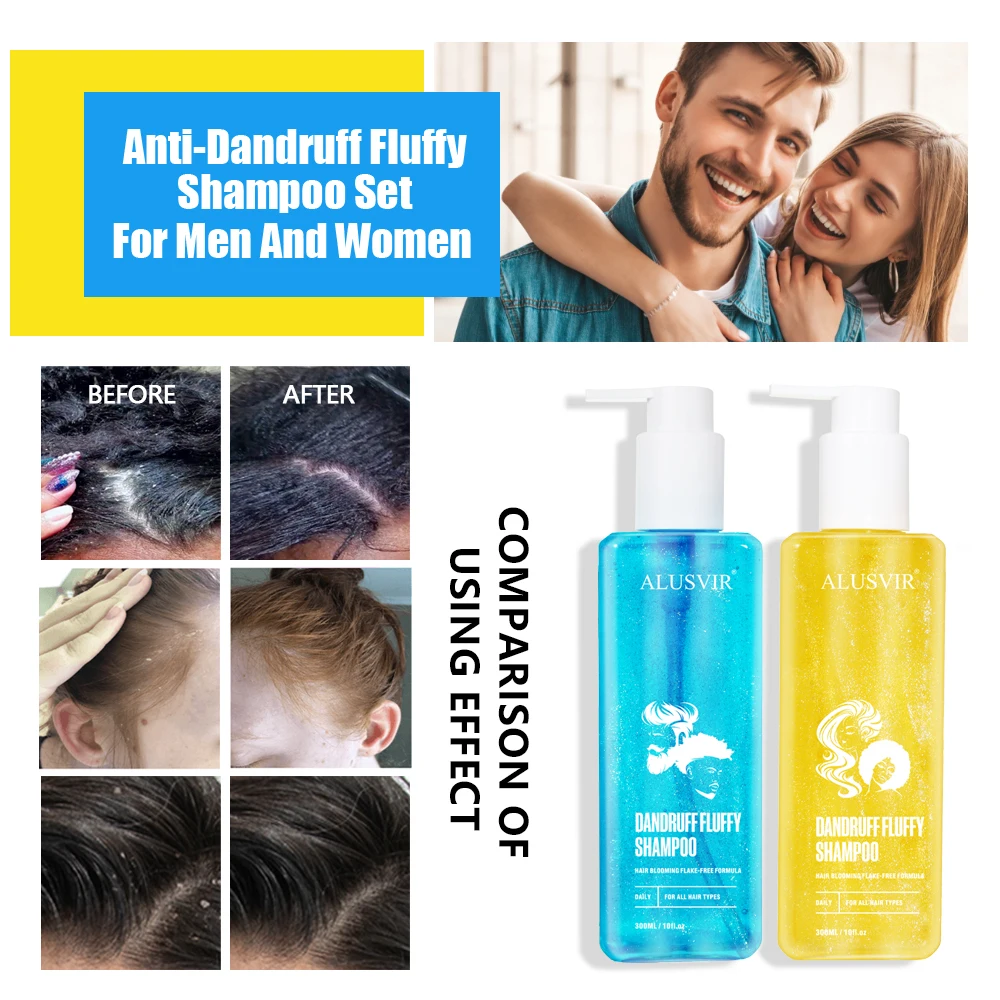 Creat Your Own Brand Organic Scalp Care Hair Product Perfume Anti-dangdruff Hair Care Shampoo Set For Men And Women