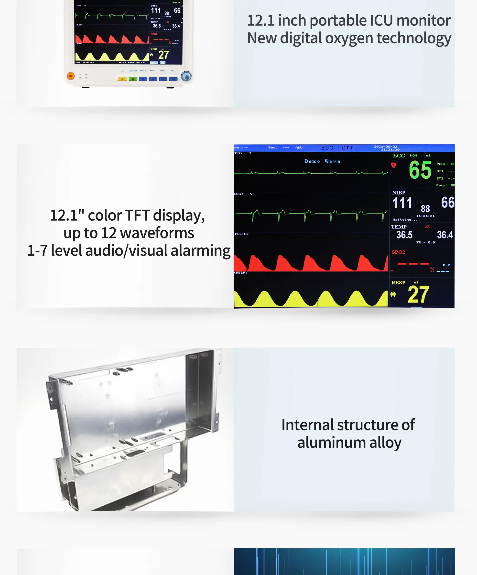Class II Multi Parameter Patient Monitor with 1 Year Warranty and 2 Years Shelf Life