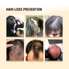Hair Growth Shampoo Organic Herbal Private Label Anti Hair Loss Hair Growth Shampoo And Conditioner