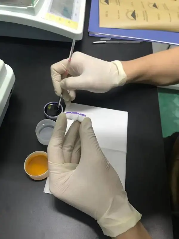 YUCERA Professional Stain Kit 26 Shades for Crowns & Veneers | Beginner-Friendly Application