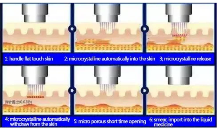 Mașină fracționată de întinerire a pielii Microneedle Acnee Scart Wart Removing Machine